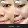 Hero Cosmetics Mighty Patch™ Original Patch - Hydrocolloid Acne Pimple Patch for Covering Zits and Blemishes, Spot Stickers for Face and Skin - Image 4