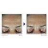 RoC Retinol Correxion Deep Wrinkle Facial Filler with Hyaluronic Acid Retinol Ounce, Christmas Gifts & Stocking Stuffers for Women and Men, 1 Fl Oz (Packaging May Vary) - Image 4