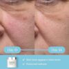 ELEMIS Dynamic Resurfacing Facial Pads | Gentle Dual-Action Textured Treatment Pads Conveniently Smooth, Resurface, and Exfoliate Skin - Image 4