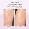 First Aid Beauty KP Bump Eraser Body Scrub Exfoliant for Keratosis Pilaris with 10% AHA – 8 oz - Image 3