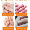 Nail Tek Repairs Damaged Nails kit.Intensive Therapy(.5OZ),Foundation(.5OZ)& Renew(.48OZ) - Image 4