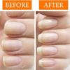 Nail Tek Repairs Damaged Nails kit.Intensive Therapy(.5OZ),Foundation(.5OZ)& Renew(.48OZ) - Image 3